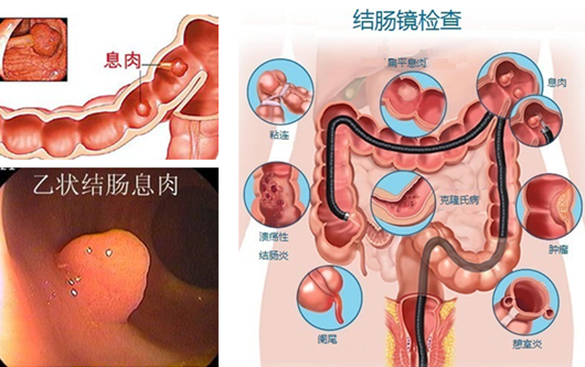 萎縮性胃炎真的“很嚇人”？看完這“七個事實”你就明白了