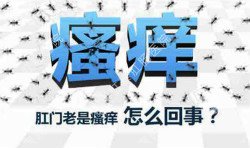 肛門瘙癢治不好嗎？先檢查病因就好辦！